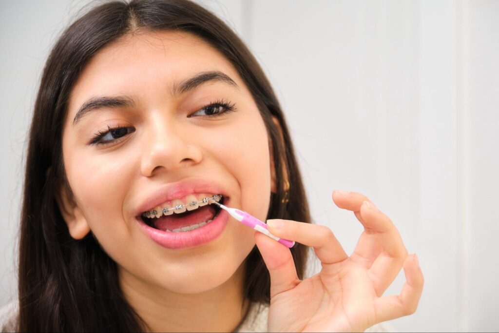 How to Support Your Teen Through Orthodontic Treatment