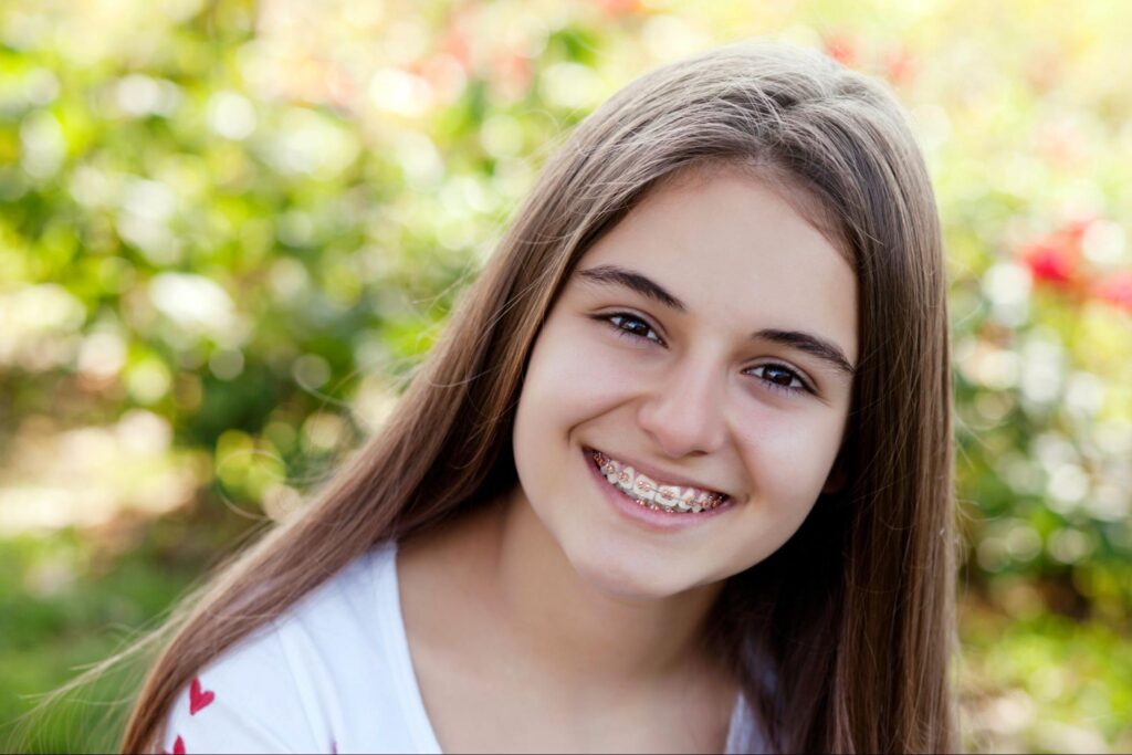 How to Support Your Teen Through Orthodontic Treatment
