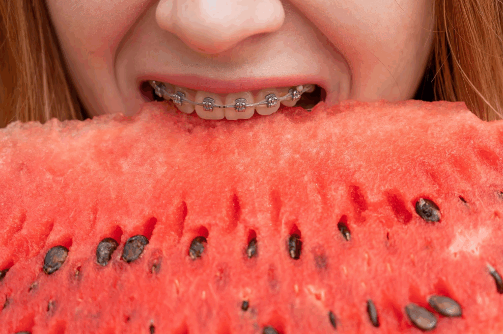 Eating With Braces